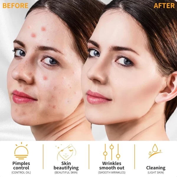 High Frequency Electrotherapy Neon Facial Skin Massage Wand for Acne Skin Rejuvenation Tightening Face Wrinkle Reducing Machine - Image 5