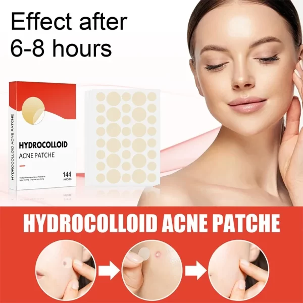 144pcs Face Acne Patch Invisible Skin Care Pimple Acne Patches Anti-inflammatory Healing Absorbing Spot Sticker Covering Acne - Image 3