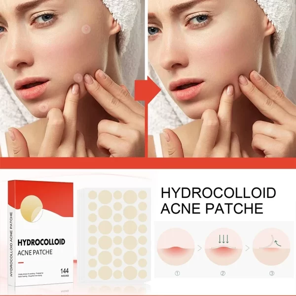 144pcs Face Acne Patch Invisible Skin Care Pimple Acne Patches Anti-inflammatory Healing Absorbing Spot Sticker Covering Acne - Image 4