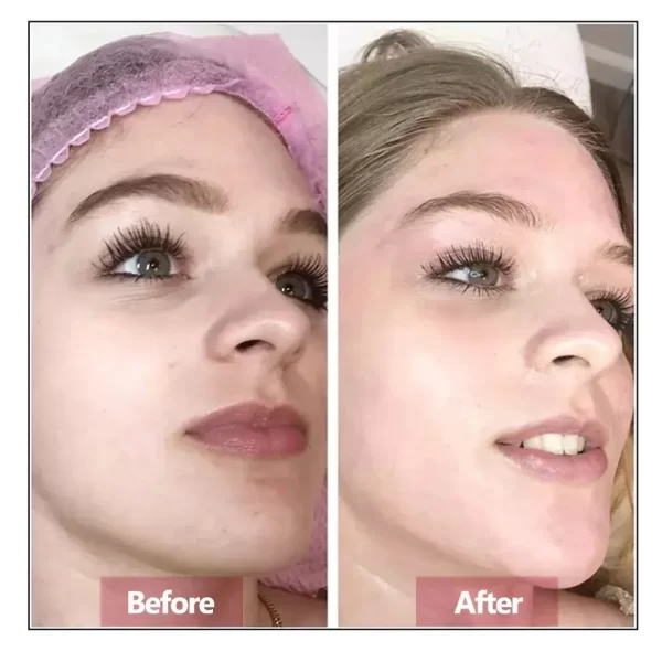 Hyaluronic Acid Face Serum Essence Skin Repair Rejuvenation Firming Moisturizing Hydrating Anti Aging - Image 3