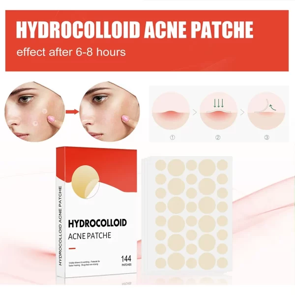 144pcs Face Acne Patch Invisible Skin Care Pimple Acne Patches Anti-inflammatory Healing Absorbing Spot Sticker Covering Acne - Image 6