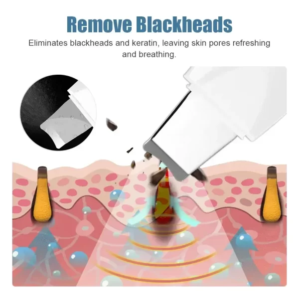 Deep Vibrate Skin Scrubber Facial Cleaner Shovel Spatula Not Ultrasonic Face ScrubberPeeling Blackhead Remover Facial Ma ssager - Image 5